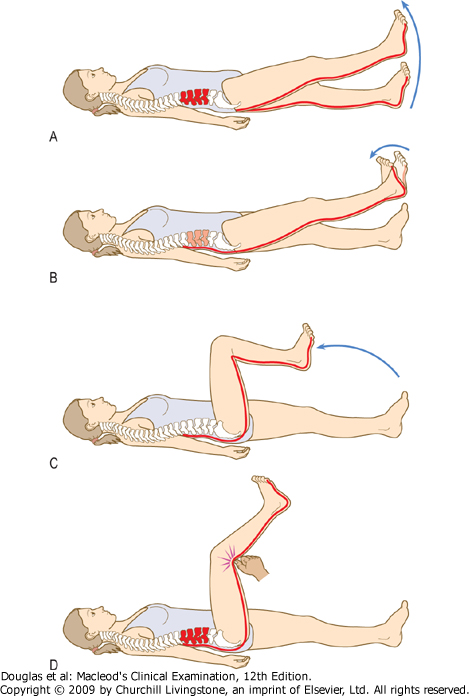 Болит нога после операции грыжи позвоночника. Упражнения при грыже l4 s1. Упражнения при грыже l4-l5. ЛФК при грыже l5-s1 пояснично-крестцового.